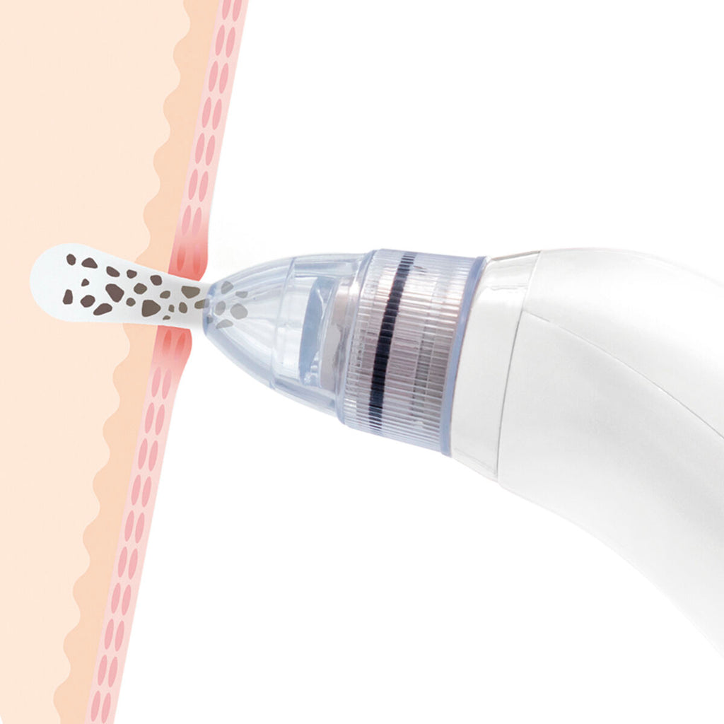 InnovaGoods Electric Mitesser-Reiniger Pore·Off – Produktansicht 2